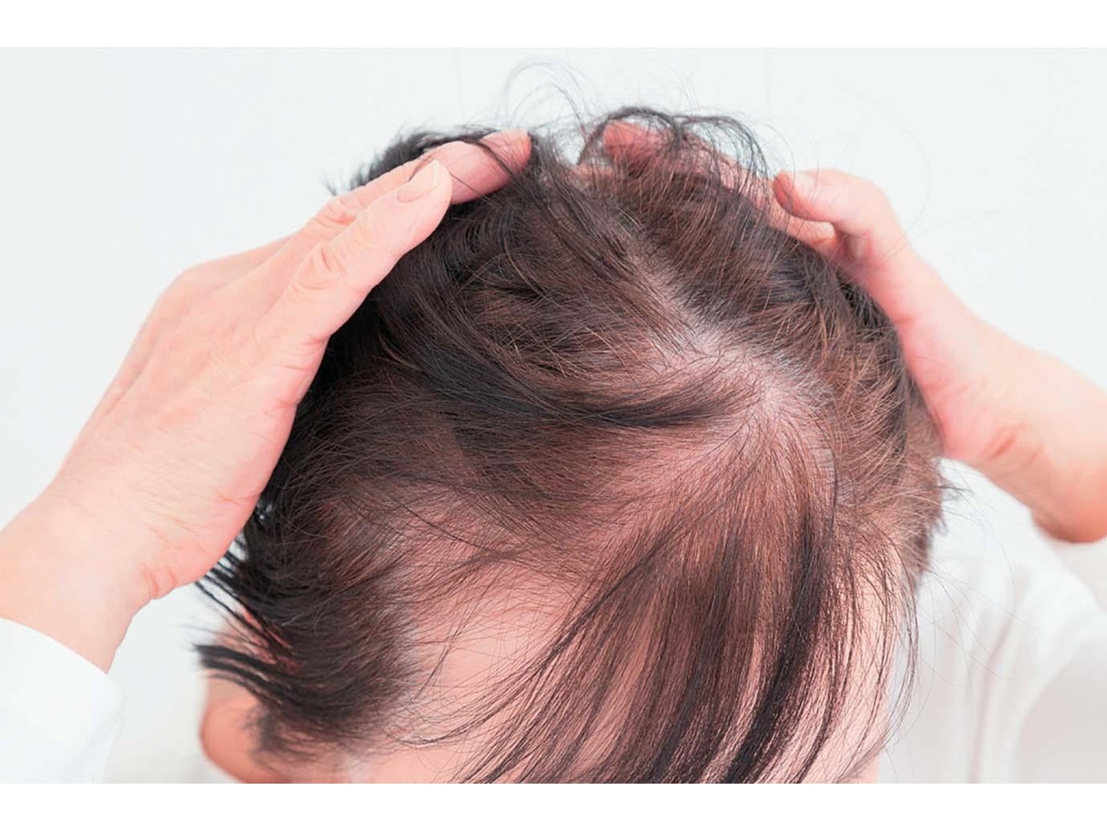 リモネア ローション 100ml 3本セット　スプレー付 1本　詰め替え用 2本 リモネア お得な3本セット | 吉田アイエム研究所公式通販サイト